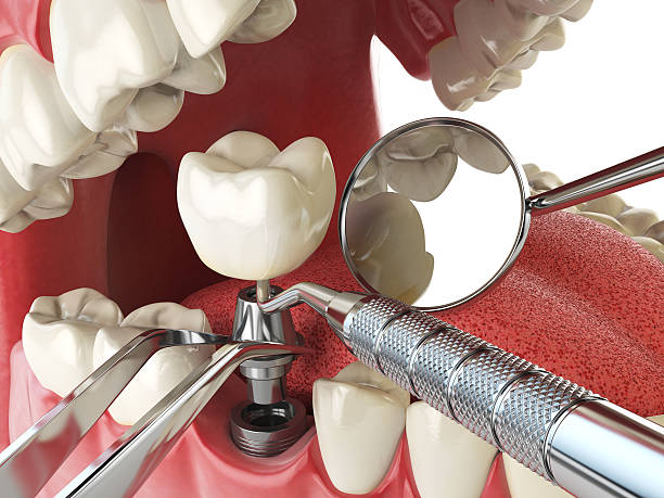 Best Pediatric Emergency Dentist in Riverview, MO